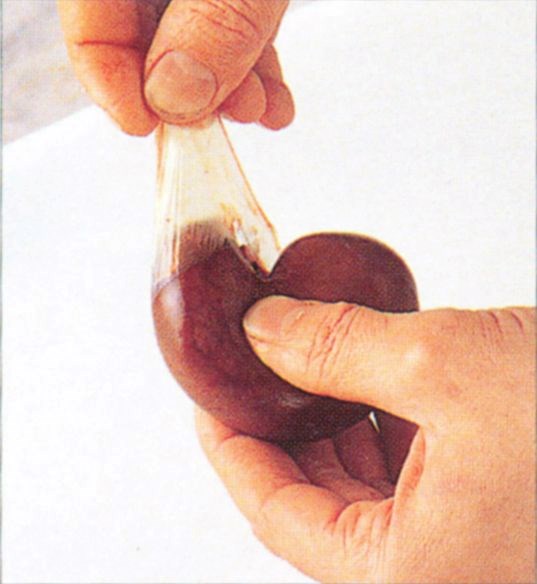 Preparing kidneys